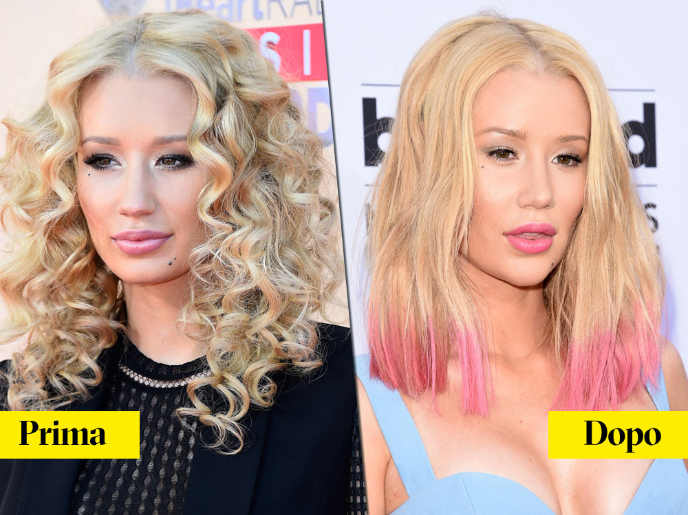 Iggy Azalea