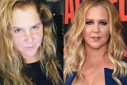 amy shumer con senza trucco