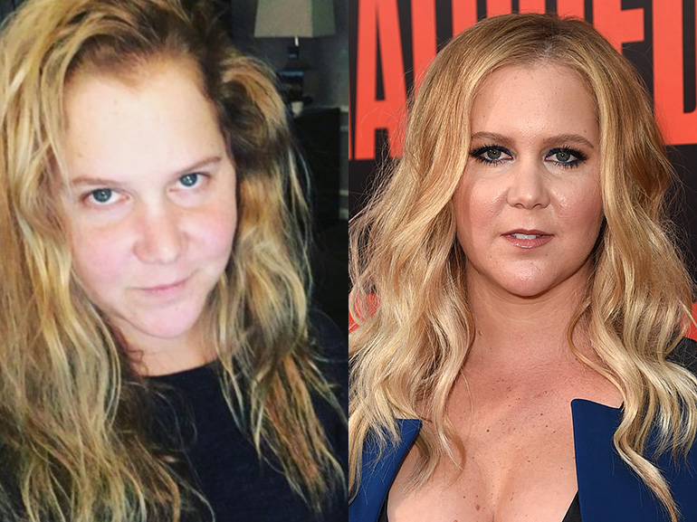 amy shumer con senza trucco