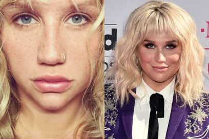 kesha con senza trucco