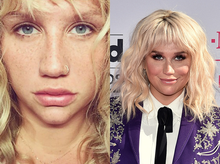 kesha con senza trucco