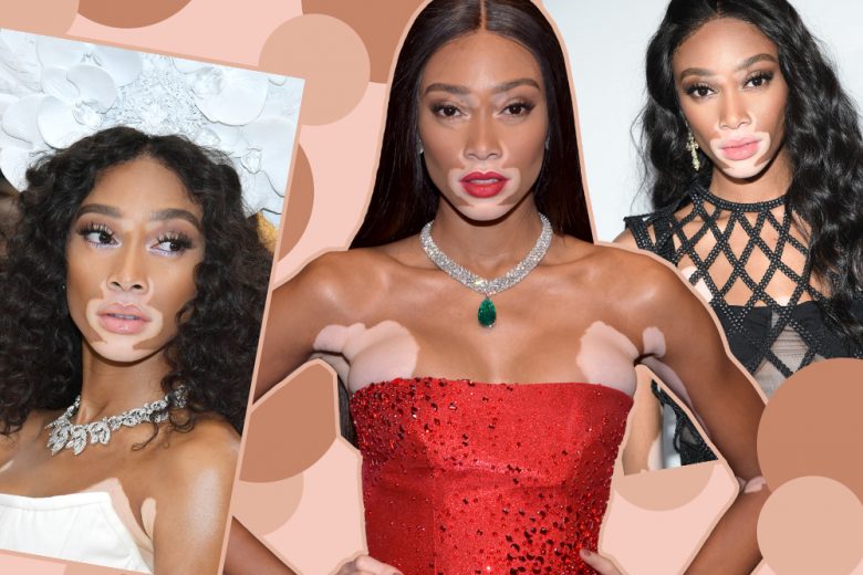 Winnie Harlow beauty look: tutto sullo stile della modella
