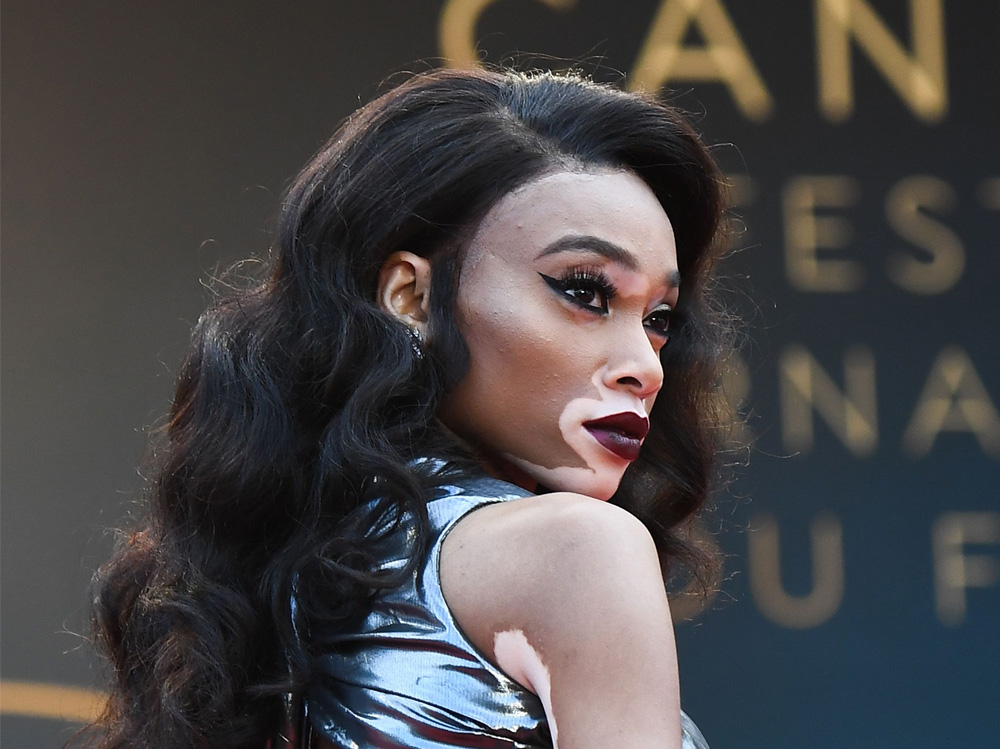 winnie harlow beauty look trucco capelli modella vitiligine (20)