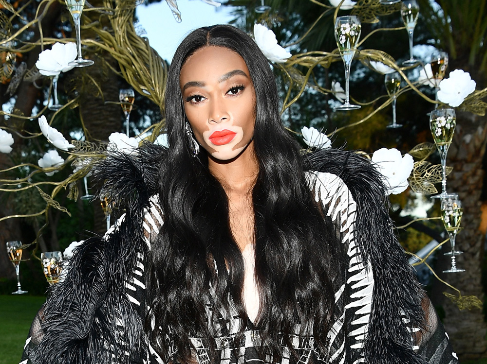 winnie harlow beauty look trucco capelli modella vitiligine (21)