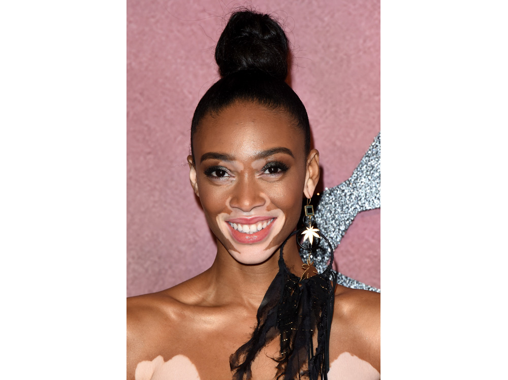 winnie harlow beauty look trucco capelli modella vitiligine (24)