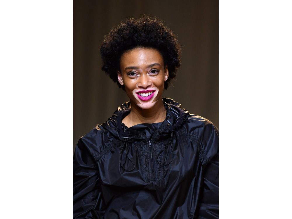 winnie harlow beauty look trucco capelli modella vitiligine (25)