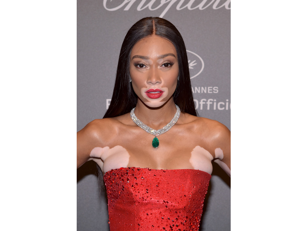 winnie harlow beauty look trucco capelli modella vitiligine (26)