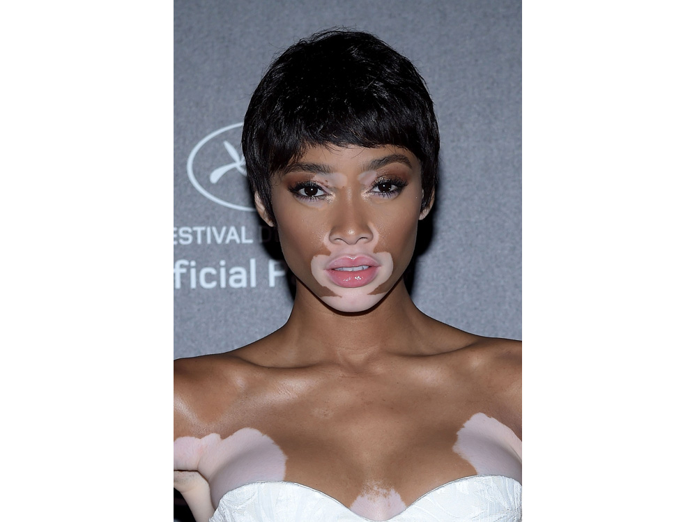 winnie harlow beauty look trucco capelli modella vitiligine (27)