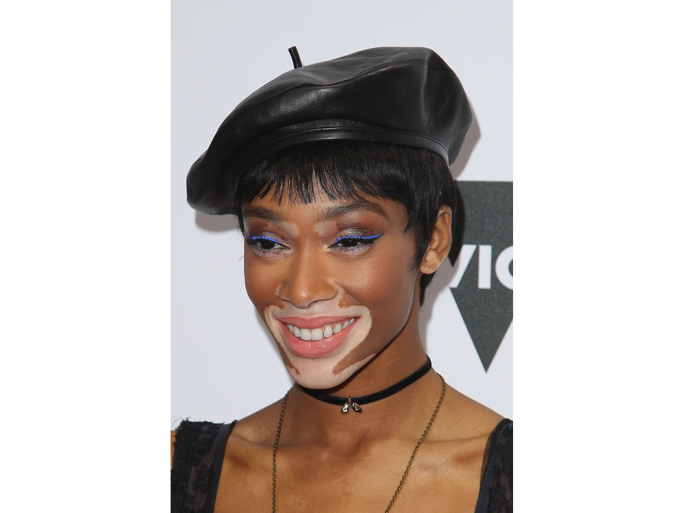 winnie harlow beauty look trucco capelli modella vitiligine (28)