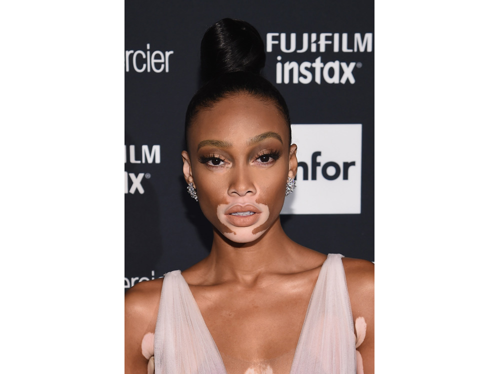 winnie harlow beauty look trucco capelli modella vitiligine (29)