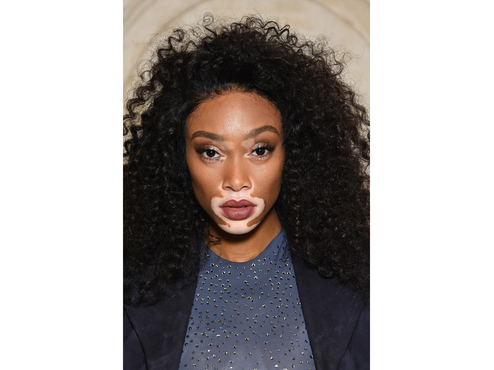 winnie harlow beauty look trucco capelli modella vitiligine (30)