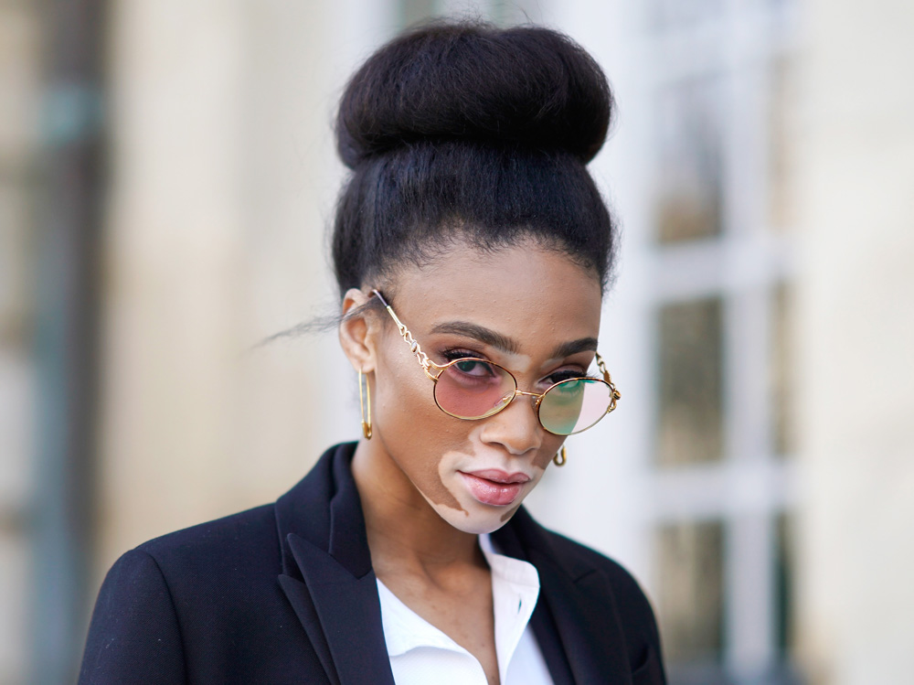 winnie harlow beauty look trucco capelli modella vitiligine (31)