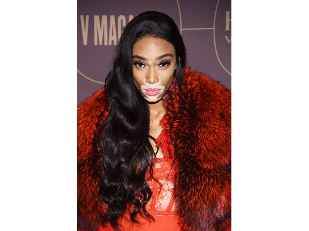 winnie harlow beauty look trucco capelli modella vitiligine (32)