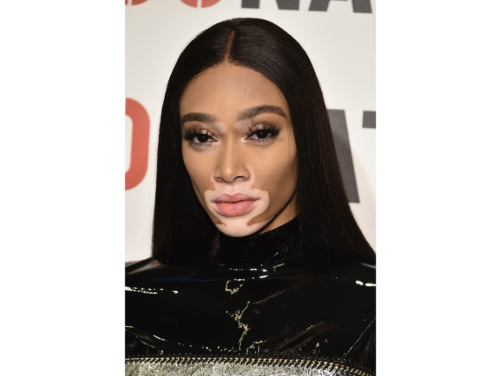 winnie harlow beauty look trucco capelli modella vitiligine (33)