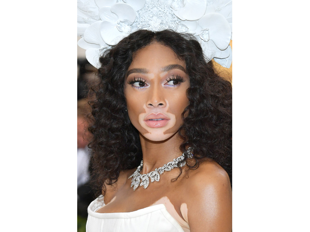 winnie harlow beauty look trucco capelli modella vitiligine (37)