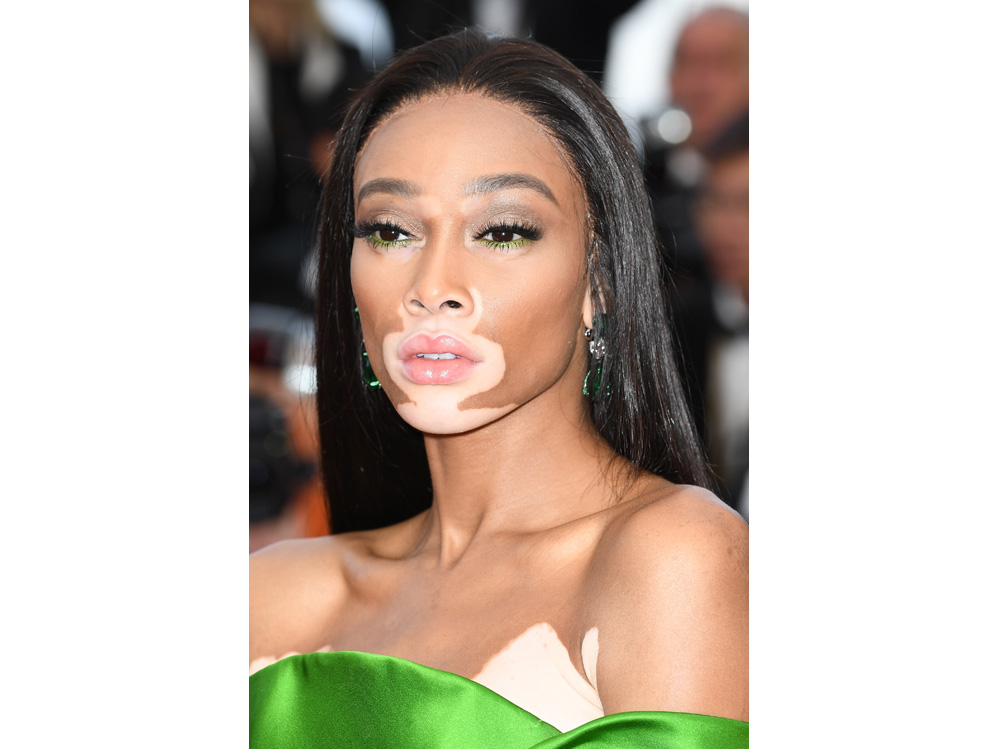 winnie harlow beauty look trucco capelli modella vitiligine (39)