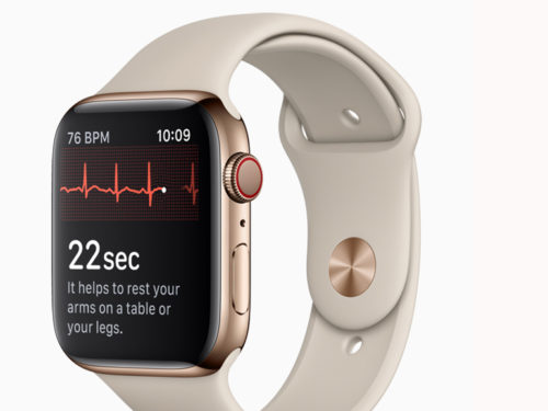 Apple Watch: perché se lo si prova poi non se ne può più fare a meno