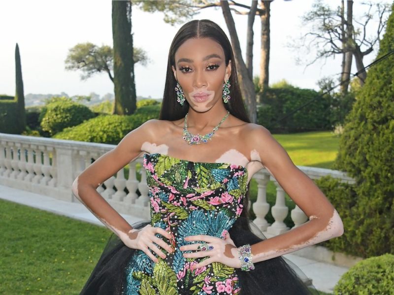winnie-harlow