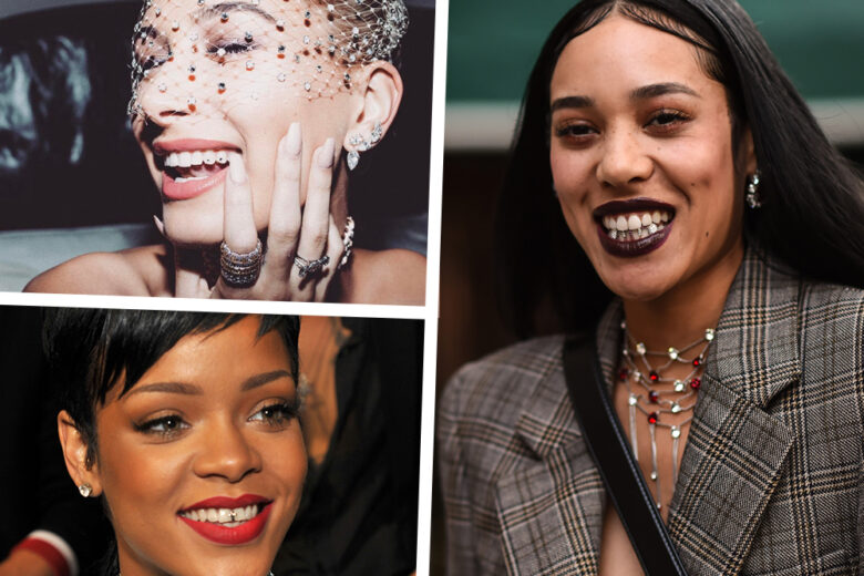 I tooth gems sono il beauty trend che tutti stavamo aspettando