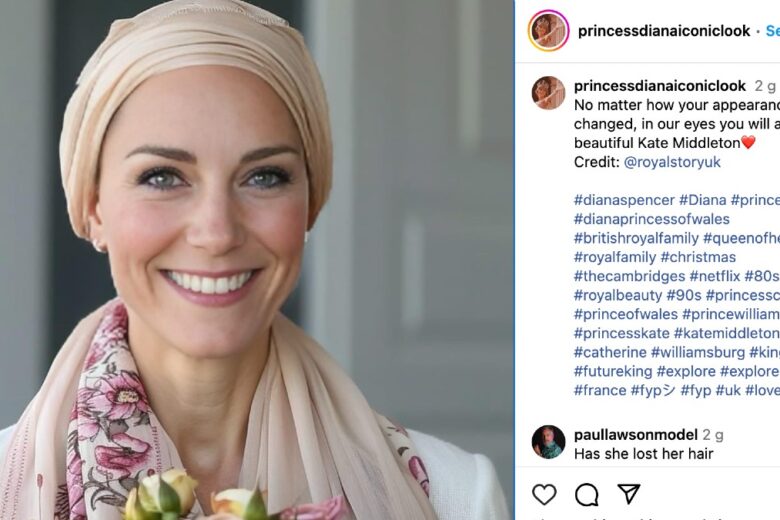 La foto di Kate Middleton senza capelli è stata creata con l’AI