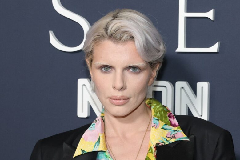 L’ultima passione delle celeb si chiama shaggy pixie cut e qui c’è tutto quello che dovete sapere
